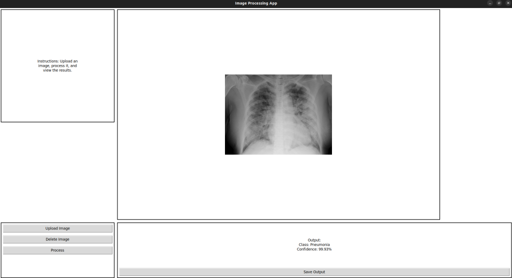 هوش مصنوعی تشخیص پنومونی